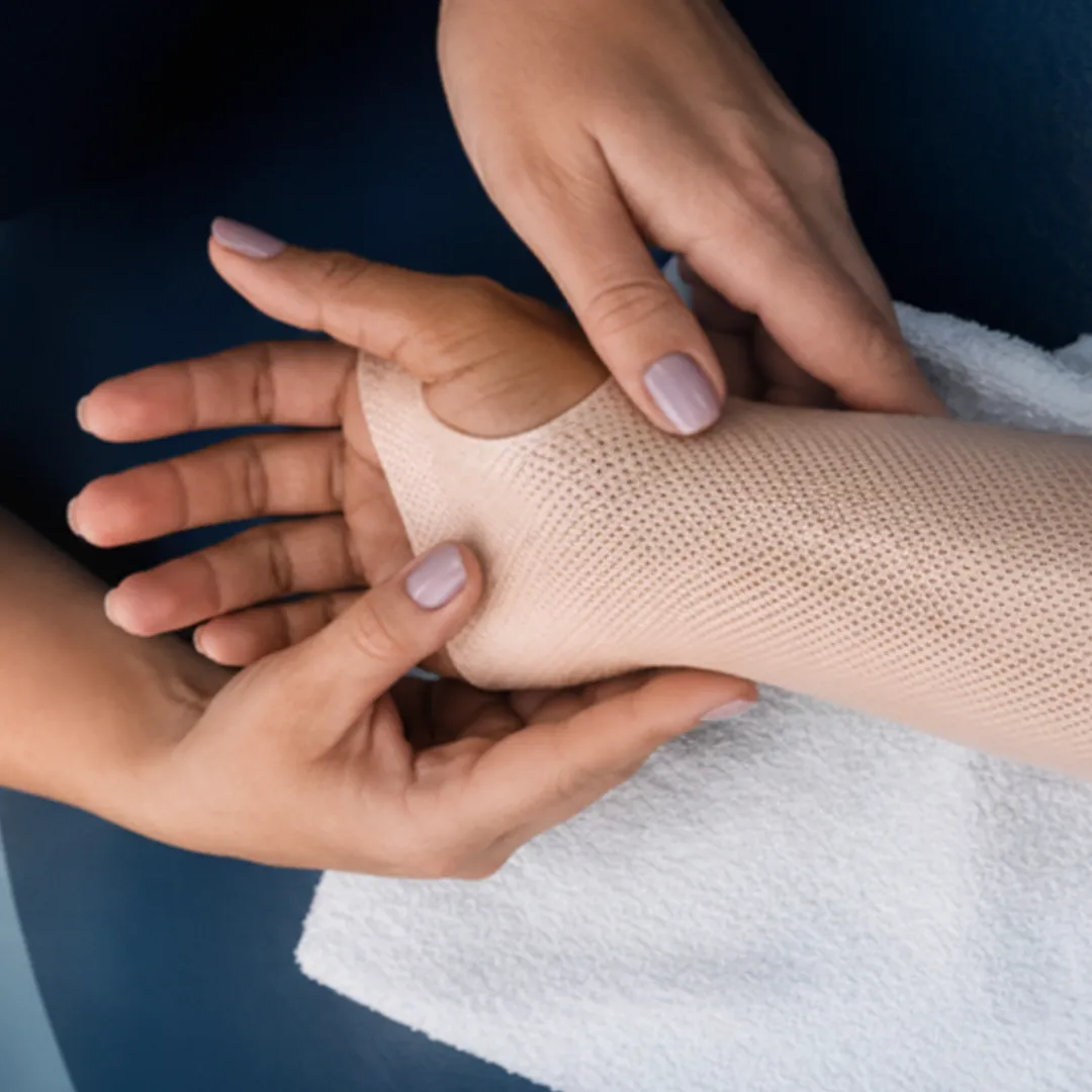 Órtese termomoldável de baixa temperatura aplicada na mão, Oficina de Órteses em Terapia da Mão